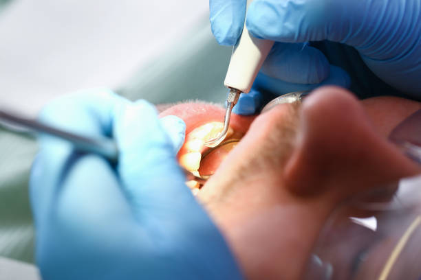 Best Knocked-Out Tooth Emergency  in Riner, VA
