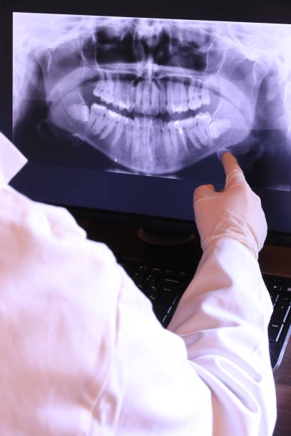 Best Dentist for Tooth Abscess  in Riner, VA